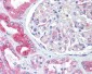 BCAP31 / BAP31 Antibody (Internal)